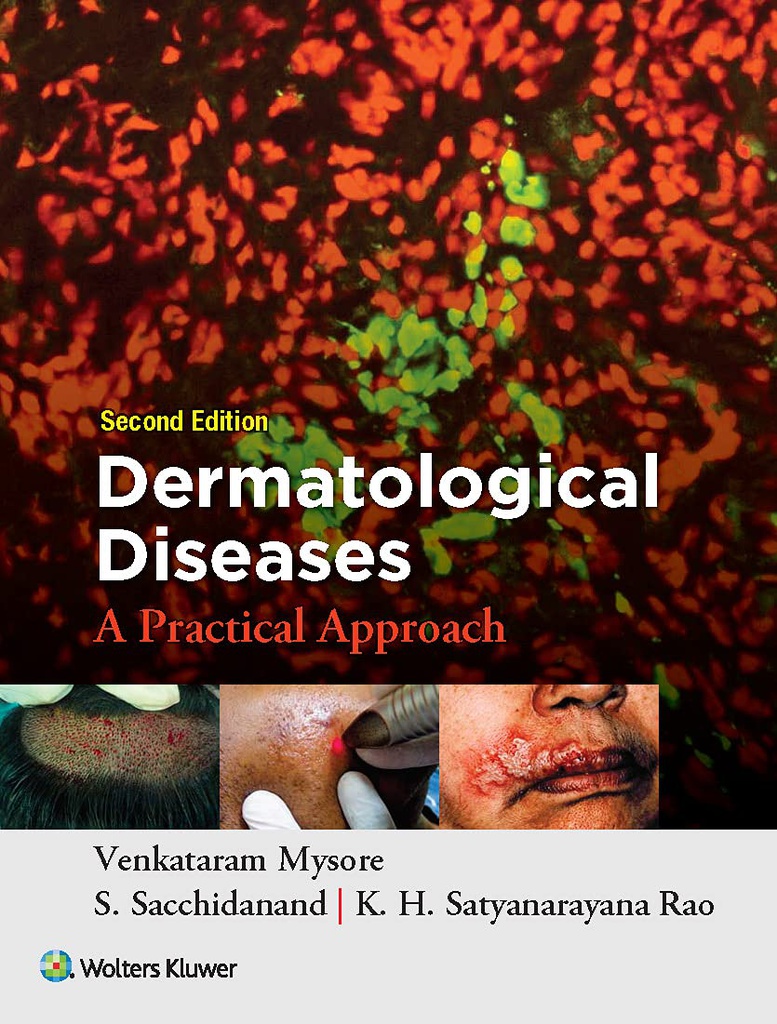 Dermatological Diseases: A Practical Approach, 2/e