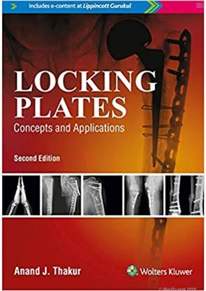 Locking Plates: Concepts and Applications, 2/e