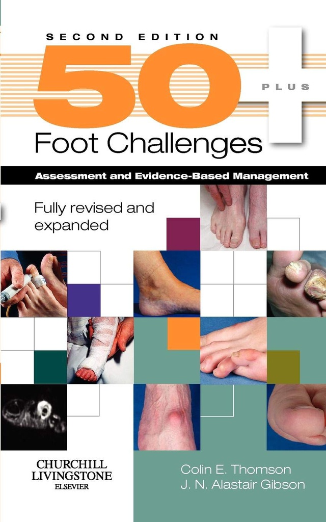 50+ Foot Challenges: Assessment and Evidence-Based Management 2ed