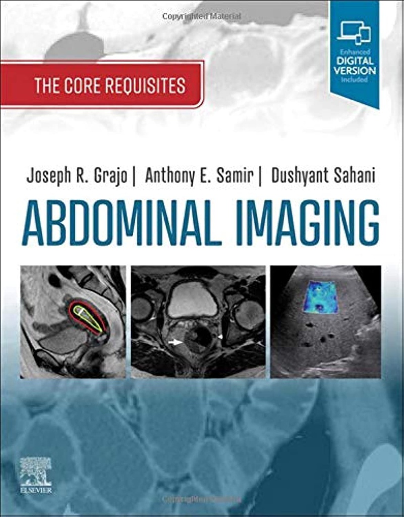 Abdominal Imaging: The Core Requisites 1ed