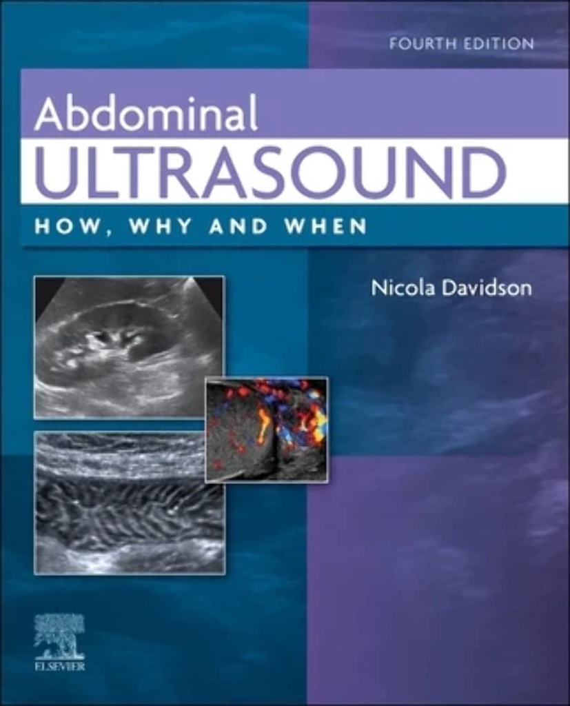 Abdominal Ultrasound: How, Why and When 4ed