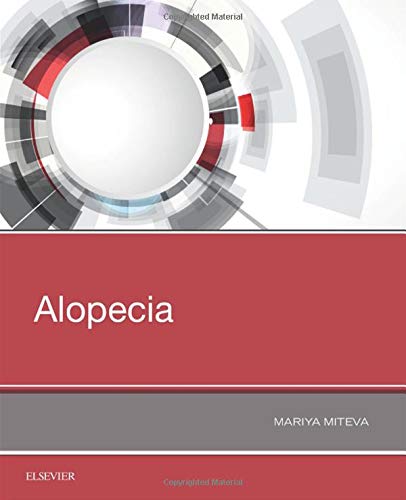 Alopecia: 1ed