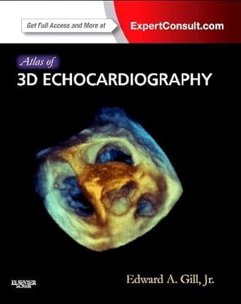 Atlas of 3D Echocardiography: Expert Consult – Online and Print 1ed