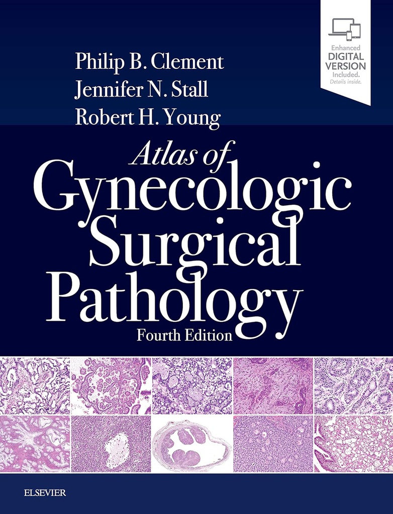 Atlas of Gynecologic Surgical Pathology: 4ed