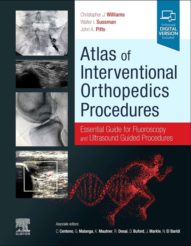 Atlas of Interventional Orthopedics Procedures: Essential Guide for Fluoroscopy and Ultrasound Guided Procedures 1ed