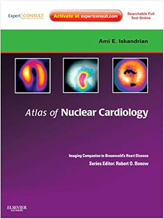 Atlas of Nuclear Cardiology: Imaging Companion to Braunwald's Heart Disease: Expert Consult - Online and Print 1ed