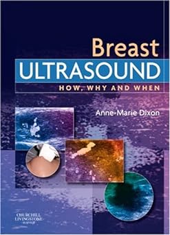 Breast Ultrasound: How, Why and When 1ed