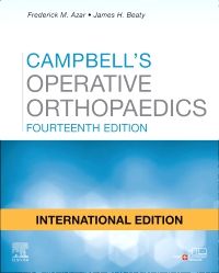 Campbell's Operative Orthopaedics, IE, 4-VOL Set, 14ed