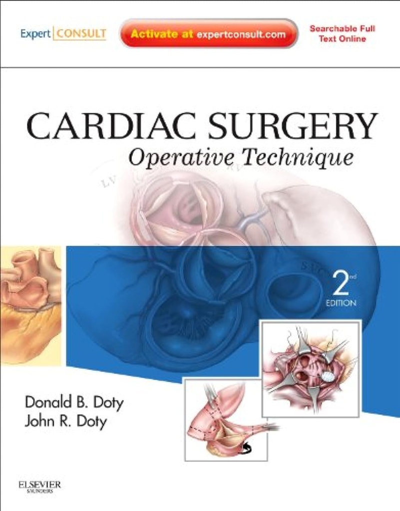 Cardiac Surgery: Operative Technique - Expert Consult: Online and Print 2ed