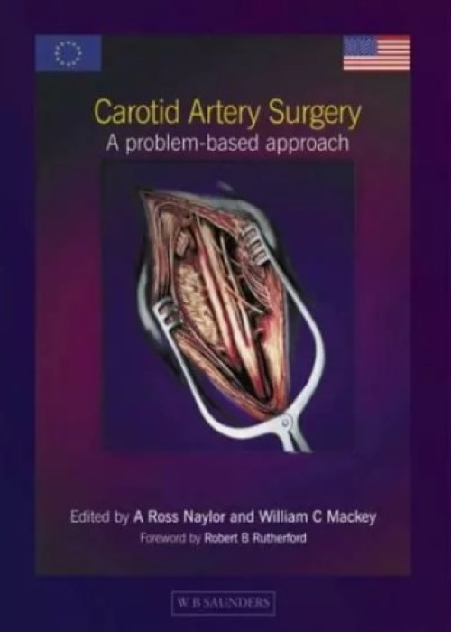 Carotid Artery Surgery: A Problem-based Approach 1ed