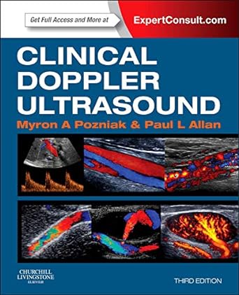 Clinical Doppler Ultrasound: Expert Consult: Online and Print 3ed