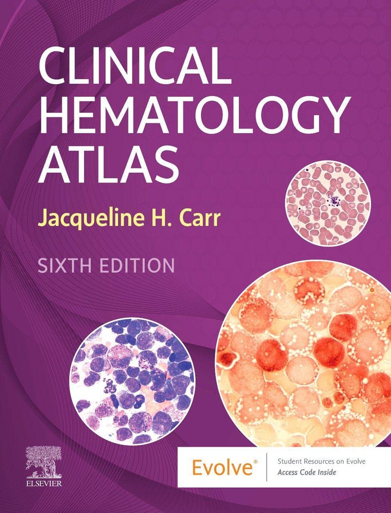 Clinical Hematology Atlas: 6ed