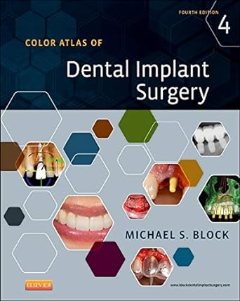 Color Atlas of Dental Implant Surgery: 4ed
