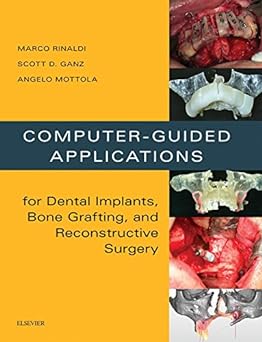 Computer-Guided Applications for Dental Implants, Bone Grafting, and Reconstructive Surgery (adapted translation): 1ed