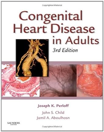 Congenital Heart Disease in Adults: 3ed