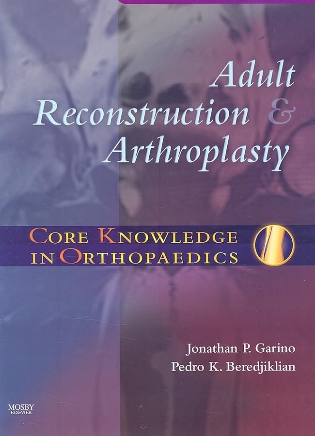 Core Knowledge in Orthopaedics: Adult Reconstruction and Arthroplasty: 1ed