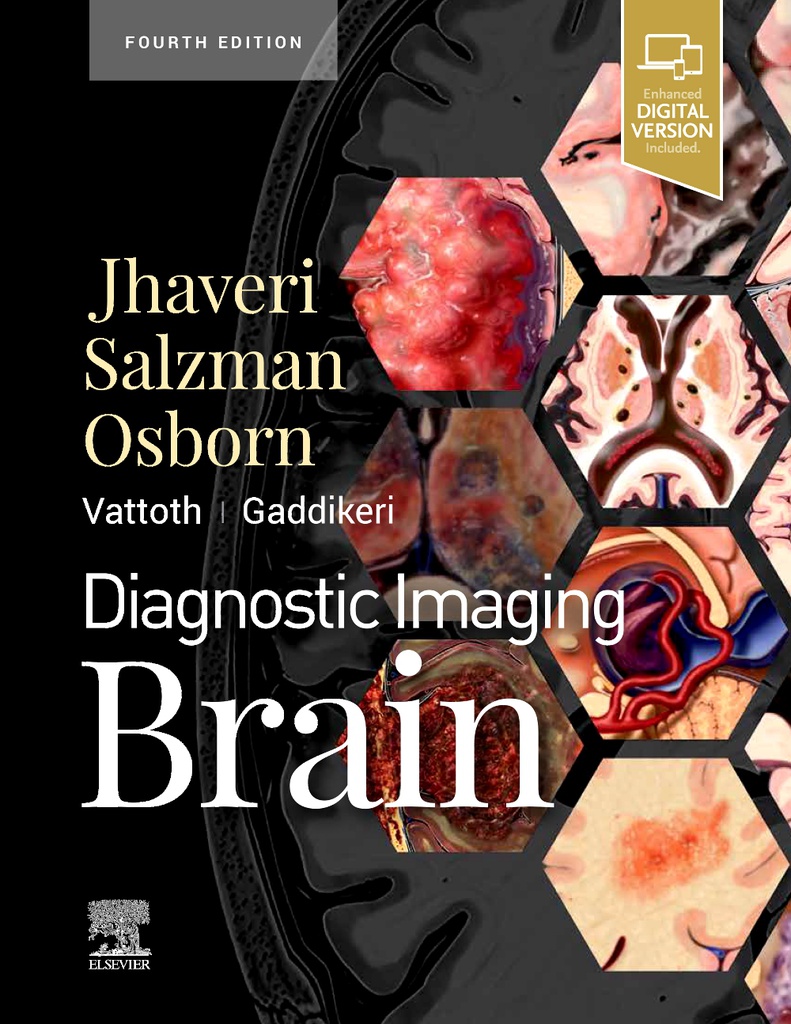 Diagnostic Imaging: Brain, 4/e