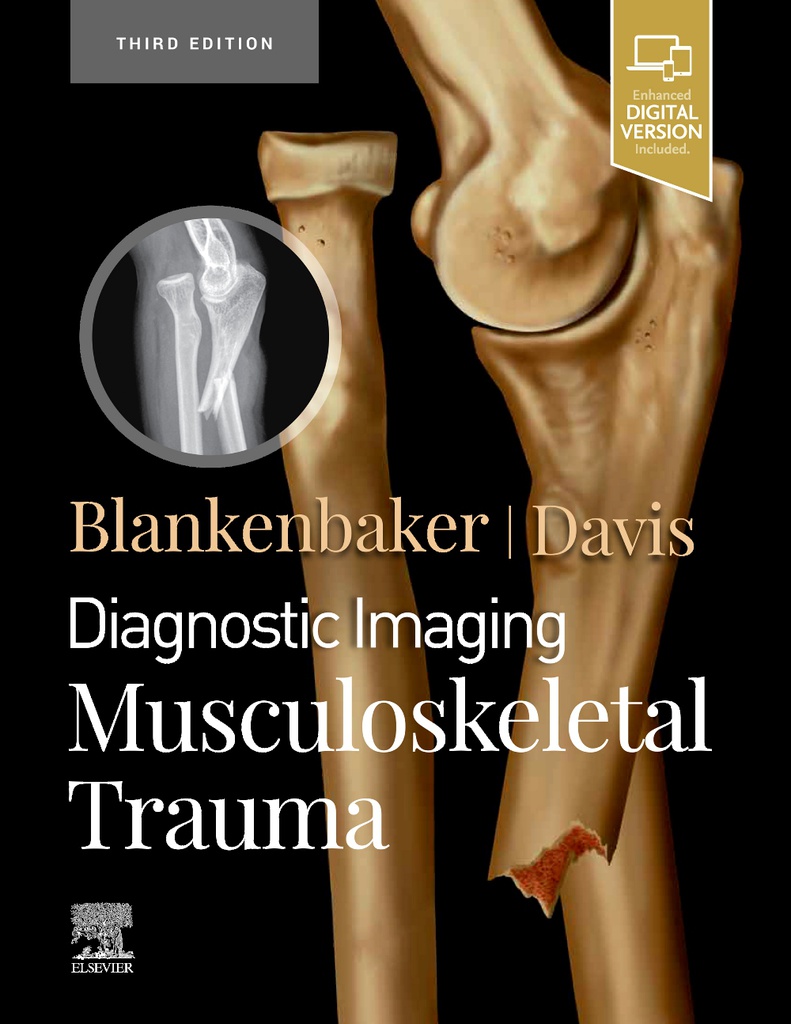 Diagnostic Imaging: Musculoskeletal Trauma, 3/e