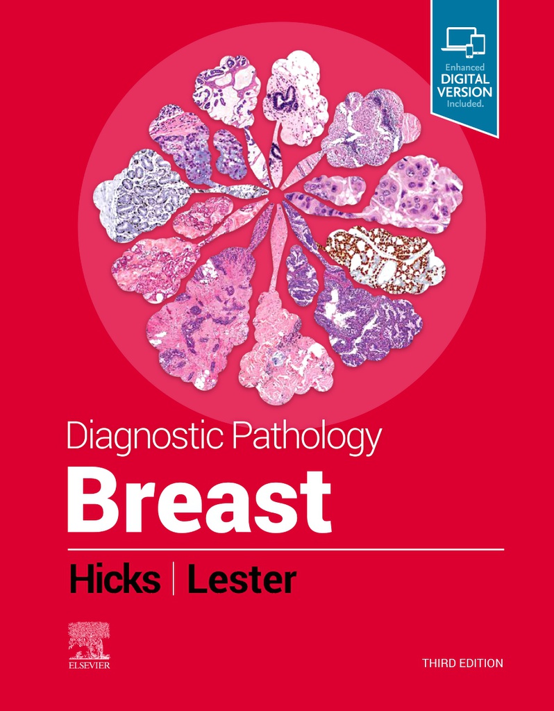 Diagnostic Pathology: Breast, 3/e