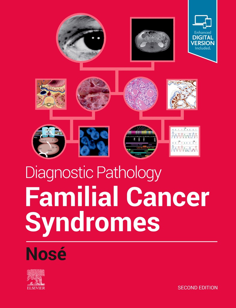 Diagnostic Pathology: Familial Cancer Syndromes, 2/e