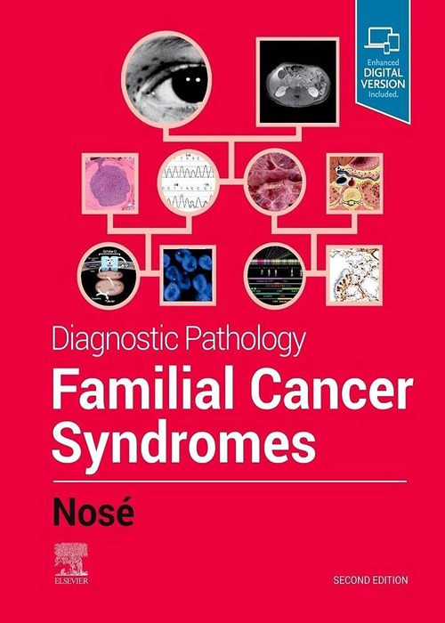 Diagnostic Pathology: Familial Cancer Syndromes: 2ed