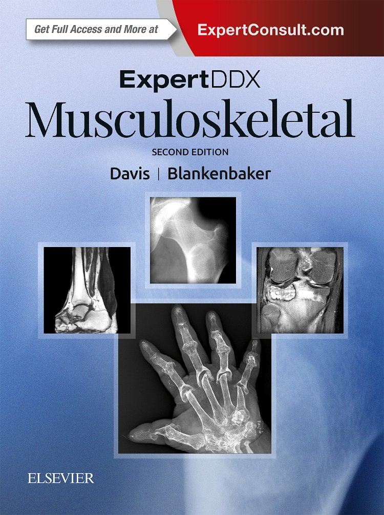 ExpertDDx: Musculoskeletal: 2ed