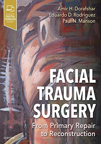 Facial Trauma Surgery: From Primary Repair to Reconstruction 1ed