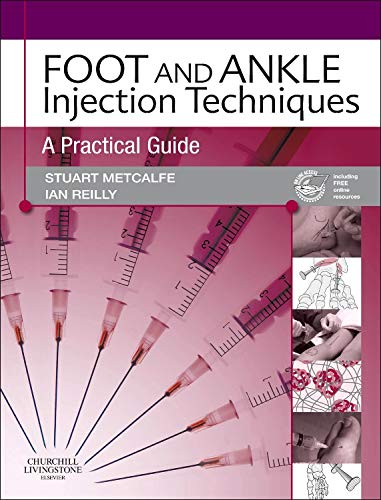 Foot and Ankle Injection Techniques: A Practical Guide 1ed