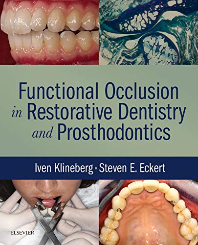 Functional Occlusion in Restorative Dentistry and Prosthodontics: 1ed