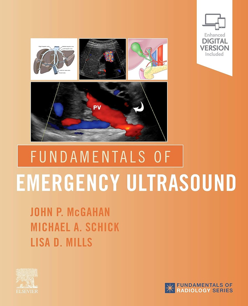 Fundamentals of Emergency Ultrasound: 1ed