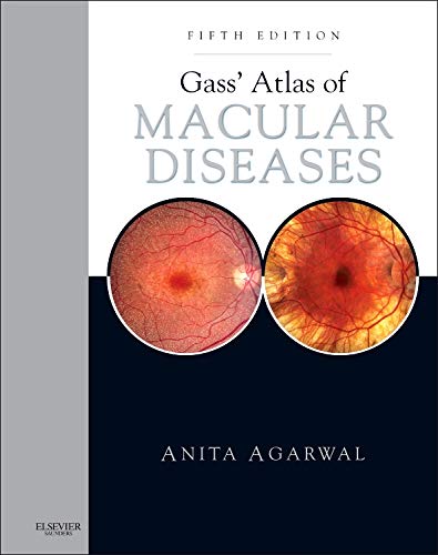 Gass' Atlas of Macular Diseases: 2-VOL Set - Expert Consult: Online and Print 5ed