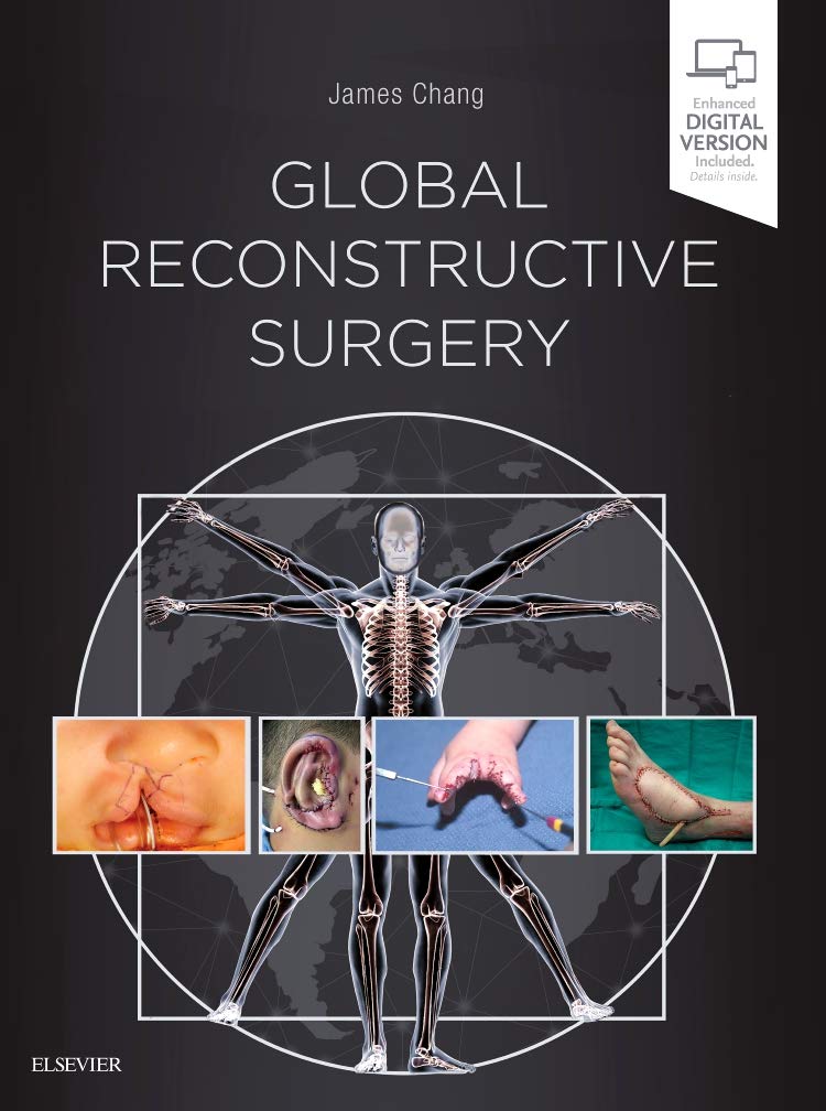 Global Reconstructive Surgery: 1ed