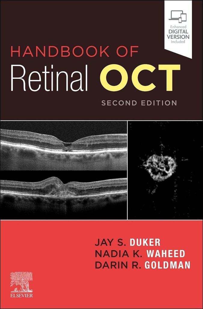 Handbook of Retinal OCT: Optical Coherence Tomography: 2ed