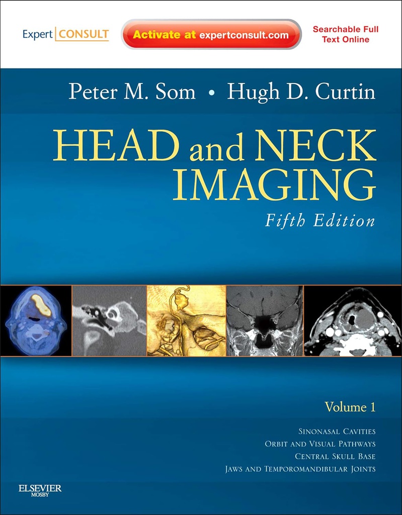 Head and Neck Imaging - 2 VOL Set: Expert Consult- Online and Print 5ed