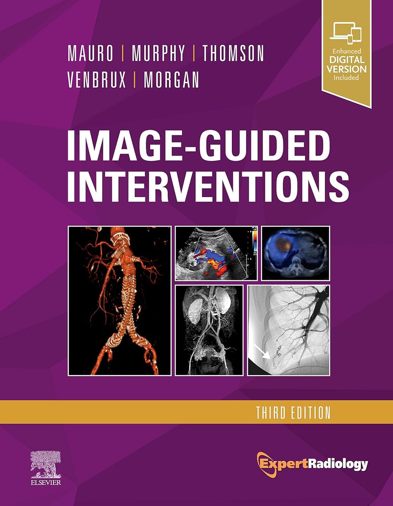 Image-Guided Interventions: Expert Radiology Series 3ed