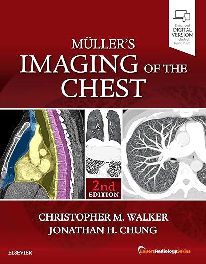 Muller's Imaging of the Chest: Expert Radiology Series 2ed