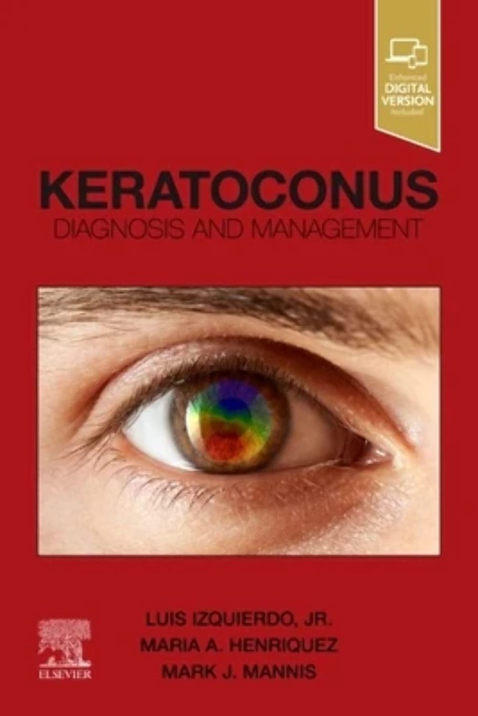 Keratoconus: Diagnosis and Management 1ed