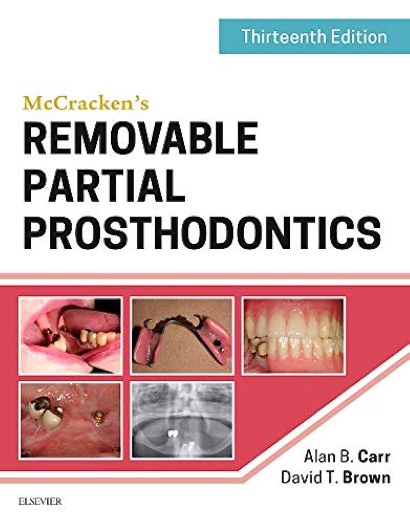 McCracken's Removable Partial Prosthodontics: 13ed