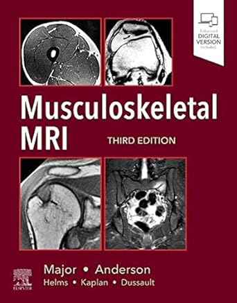 Musculoskeletal MRI: 3ed