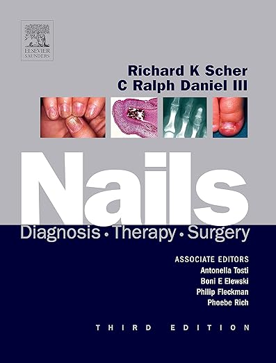 Nails: Diagnosis, Therapy, Surgery 3ed