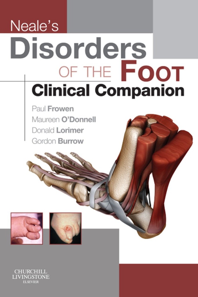 Neale's Disorders of the Foot Clinical Companion: 1ed