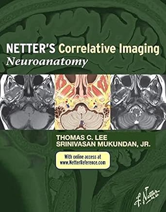 Netter’s Correlative Imaging: Neuroanatomy: with NetterReference.com Access 1ed