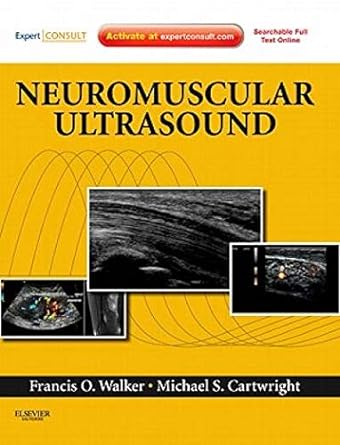 Neuromuscular Ultrasound: Expert Consult - Online and Print 1ed