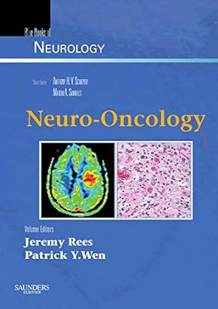 Neuro-Oncology: Blue Books of Neurology Series 1ed