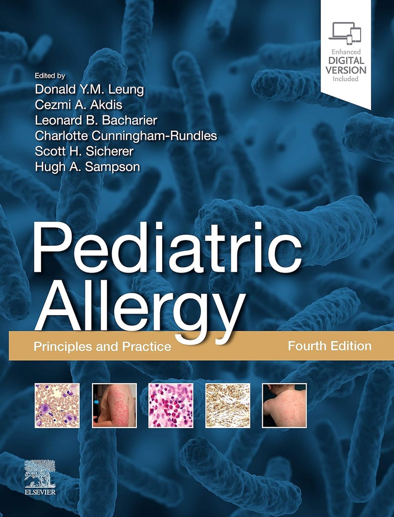 Pediatric Allergy: Principles and Practice: Principles and Practice 4ed