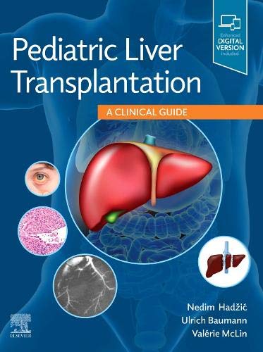 Pediatric Liver Transplantation: A Clinical Guide 1ed