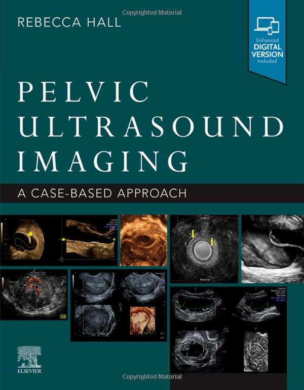 Pelvic Ultrasound Imaging: A Cased-Based Approach 1ed