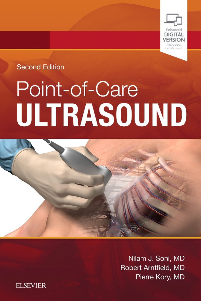 Point of Care Ultrasound: 2ed