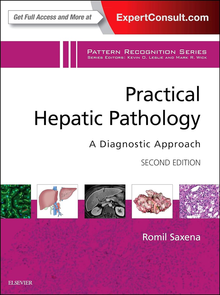 Practical Hepatic Pathology: A Diagnostic Approach: A VOL in the Pattern Recognition Series 2ed