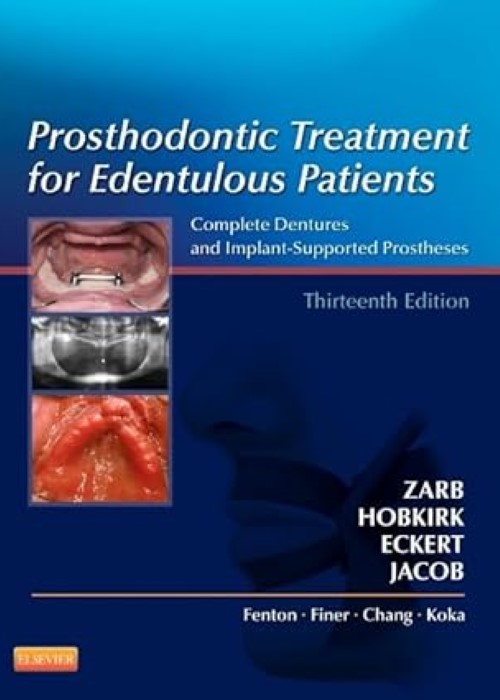 Prosthodontic Treatment for Edentulous Patients: Complete Dentures and Implant-Supported Prostheses 13ed